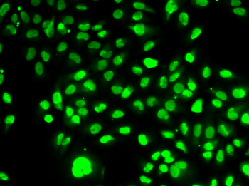 Visfatin 1 antibody