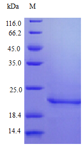 Recombinant Human Interferon beta protein(IFNB1) (Active)