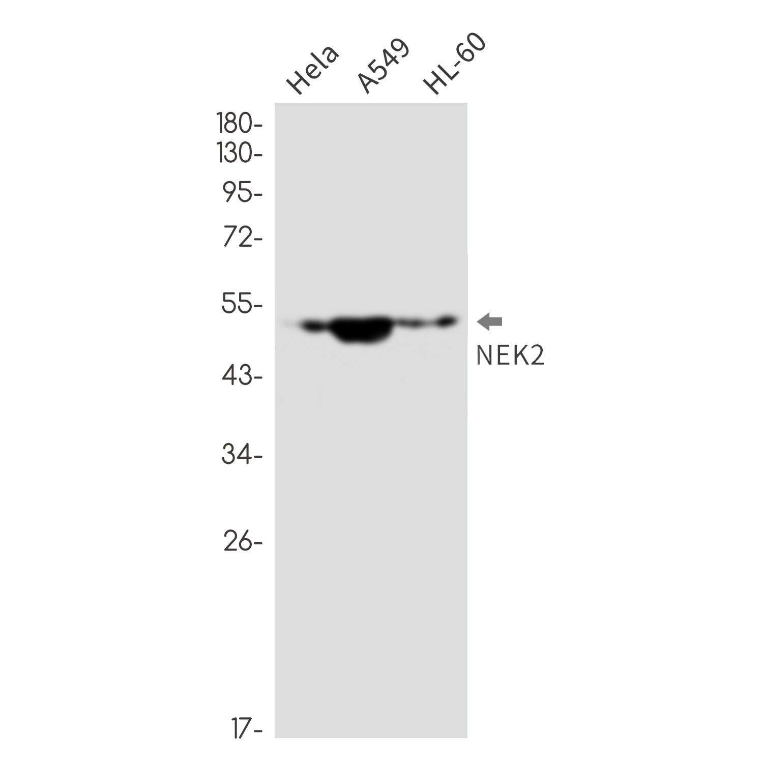 NEK2 Antibody
