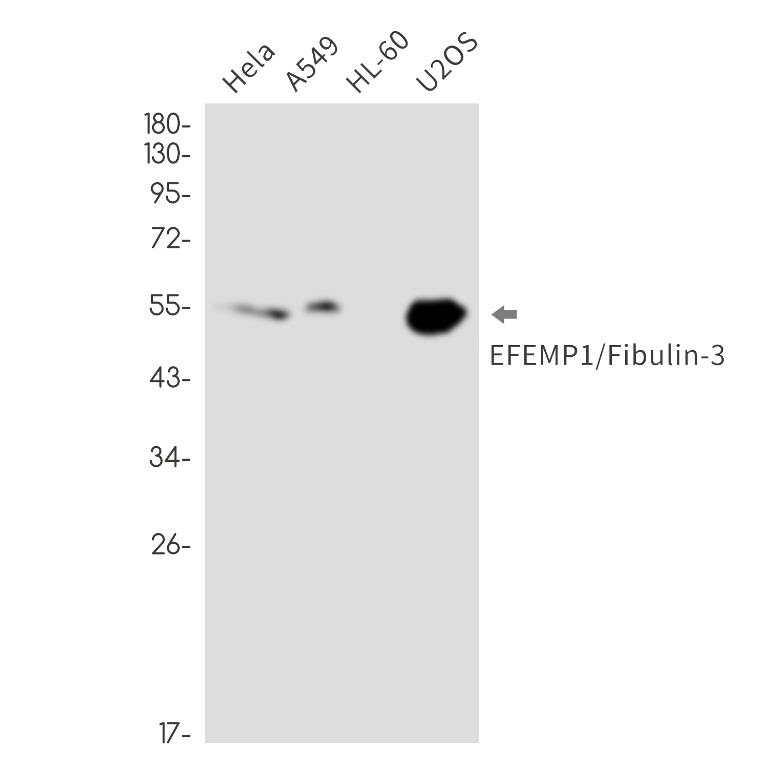 EFEMP1 Antibody