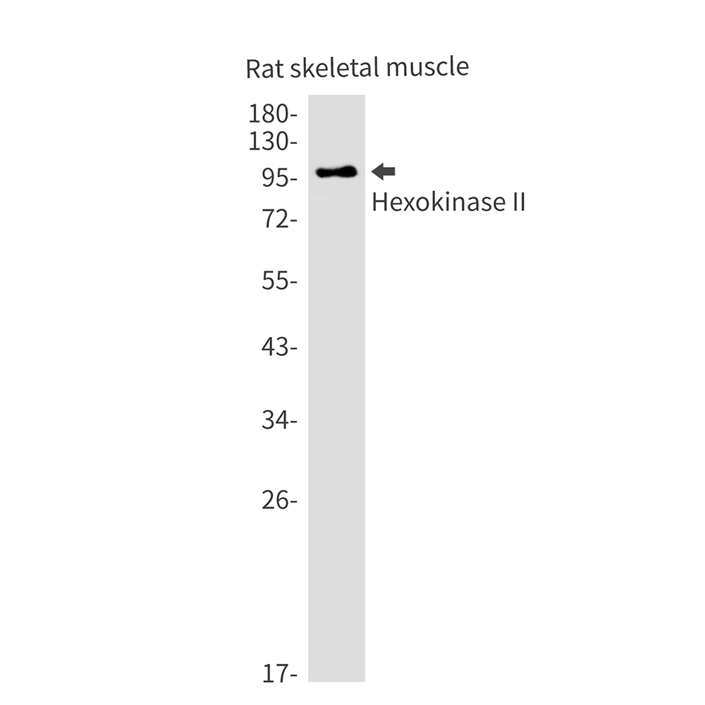 HK2 Antibody