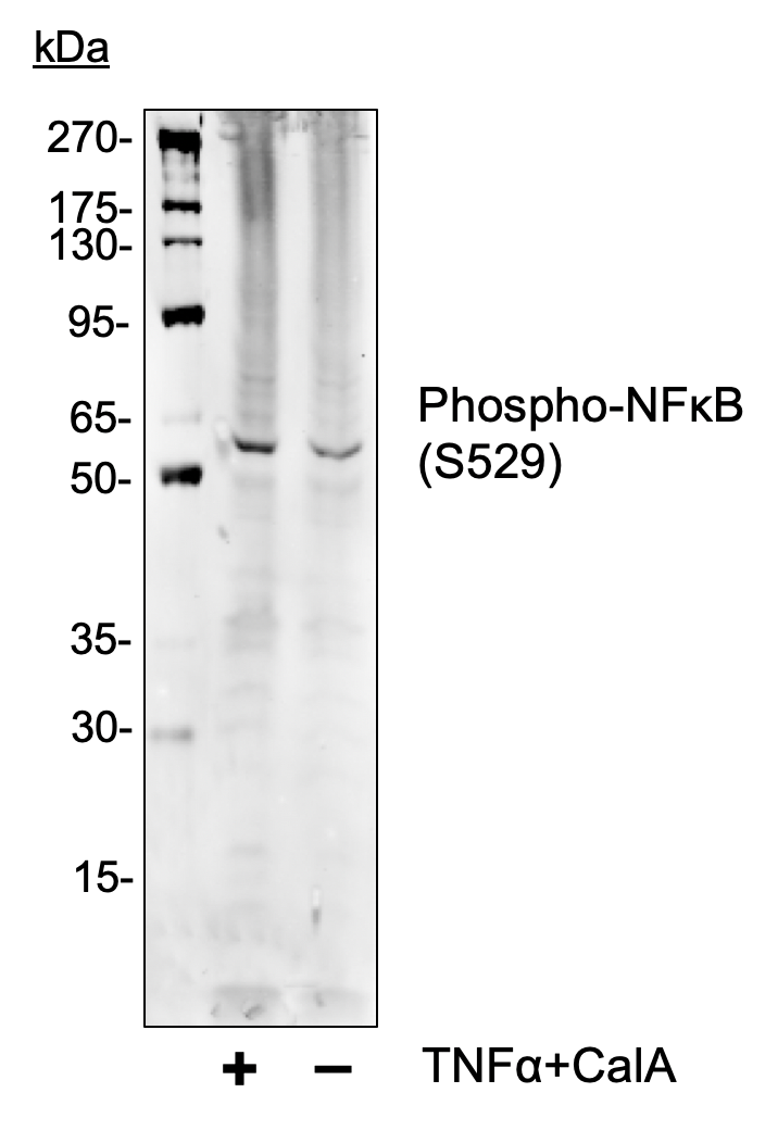 Phospho-NFkB p65 (Ser529) (A2) rabbit mAb Antibody