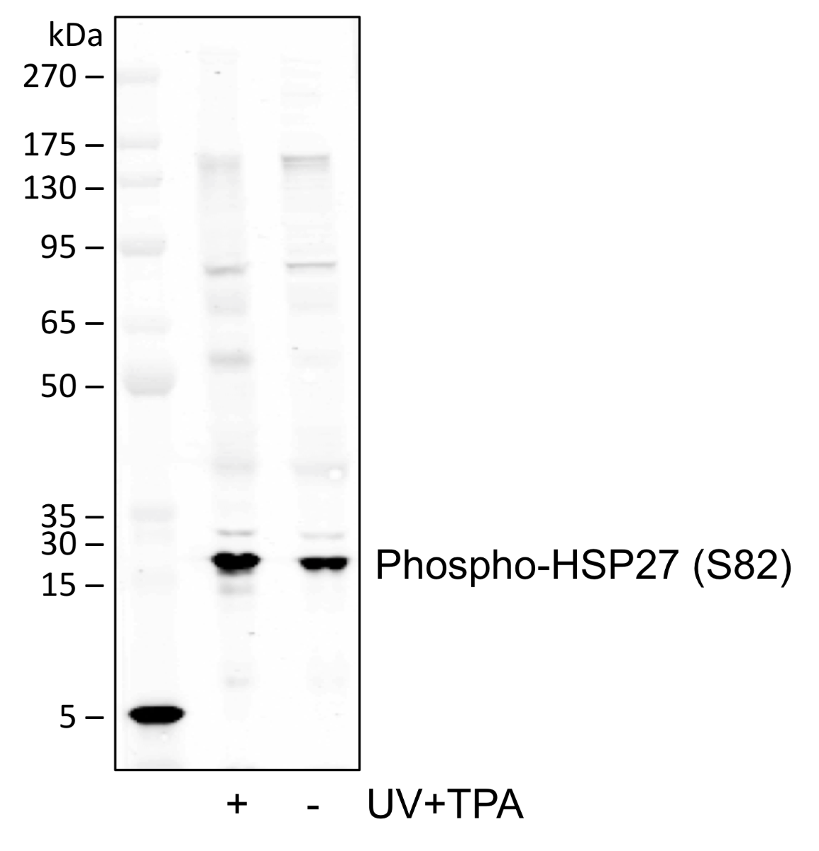 Phospho-HSP27 (Ser82) (CB2) rabbit mAb Antibody