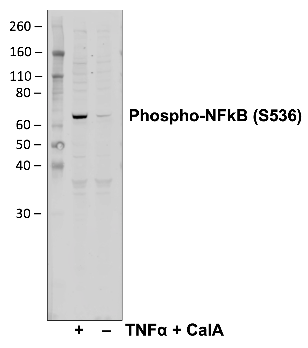 Phospho-NFkB p65 (Ser536) (C8) rabbit mAb Antibody