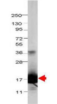 IL-1F5 antibody