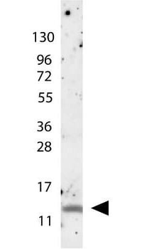 MIP-1 beta antibody