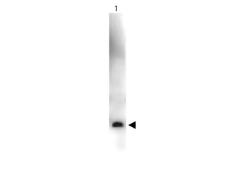 VEGF antibody (Peroxidase)