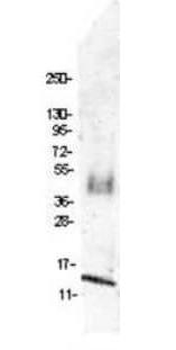 MIP 1 beta antibody