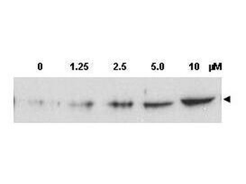 CHK2 (phospho-T68) antibody