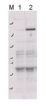 Rock-2 (phospho-Y256) antibody
