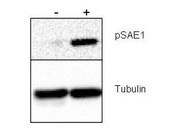 SAE1 (phospho-S185) antibody