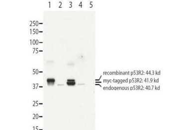 RRM2B p53R2 antibody