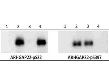 ARHGAP22 (phospho-S397) antibody