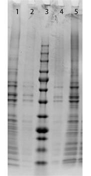 Normal Mouse Pancreas Whole Cell Lysate