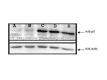 Phosphoserine antibody