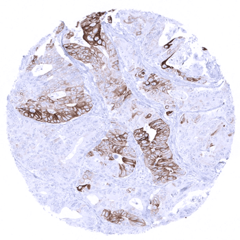 Cytokeratin 6 antibody