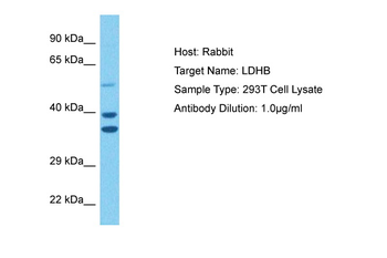 LDHB antibody
