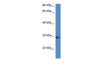 Naa11 antibody