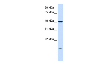 TMEM79 antibody