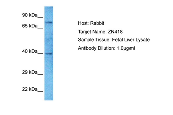 ZN418 antibody