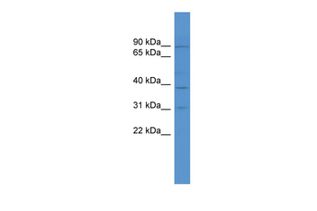 TBC1D26 antibody