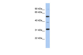 TBC1D26 antibody