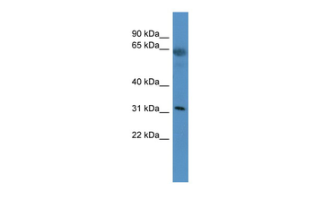 OR2T29 antibody