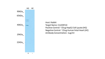 C12orf10 antibody