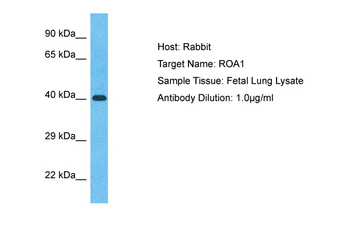 ROA1 antibody