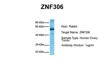 ZKSCAN3 antibody