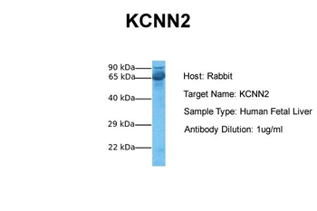 KCNN2 antibody