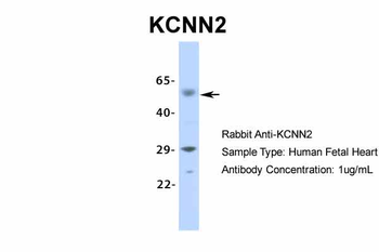 KCNN2 antibody