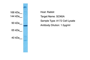 SCN5A antibody