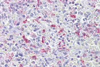 EZH1 antibody