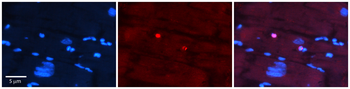 IKZF4 antibody