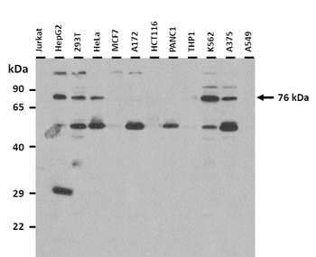 RNF139 antibody