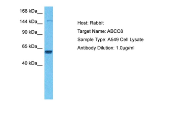 ABCC8 antibody