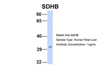 SDHB antibody