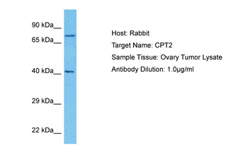 CPT2 antibody