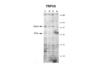 TRPV5 antibody