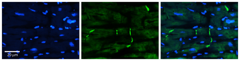 PERP antibody