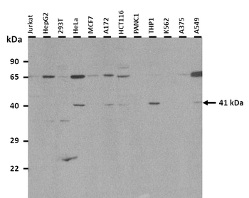 TRIB1 antibody