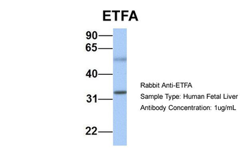 ETFA antibody