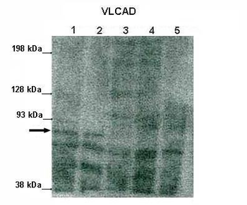 ACADVL antibody