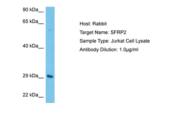 SFRP2 antibody