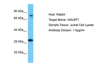 GALNT7 antibody