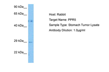 PPR5 antibody