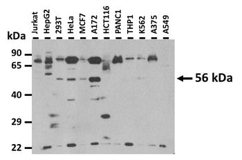 GLIS2 antibody