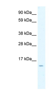 CCL7 antibody