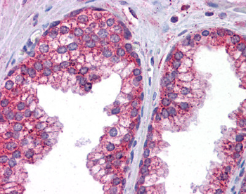 STAT6 antibody